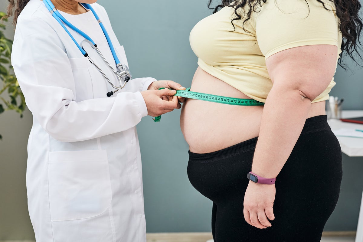 Scientists discover five new genes which increase obesity risk